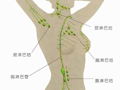 淋巴水肿最新疗法，科技重塑生活新篇章